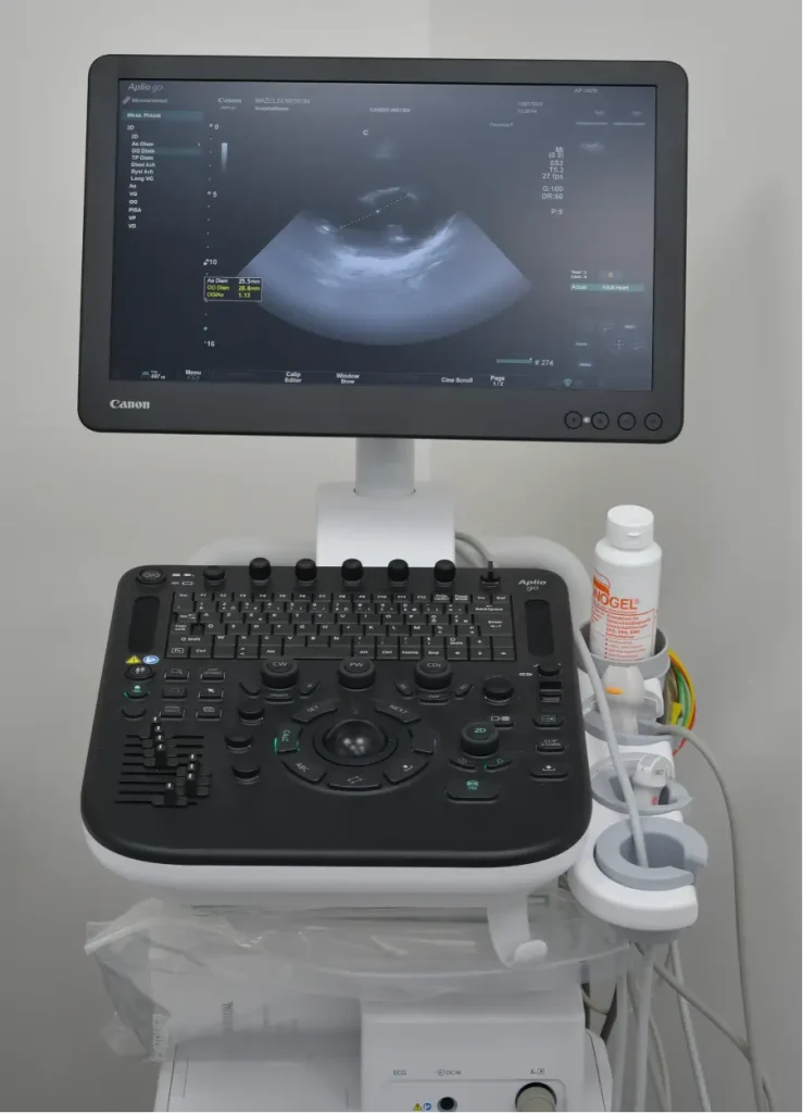 Echographie